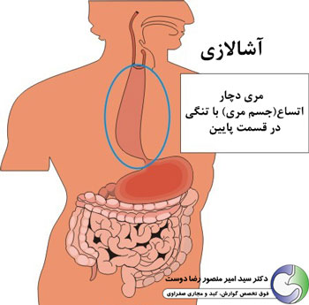 تعریف آشالازی