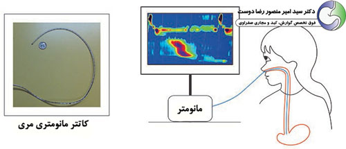 مانومتری مری 